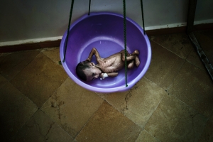 SAADA, YEMEN- 2017, OCT: Ce bÃ©bÃ© (qui n'a pas encore de nom) a Ã©tÃ© apportÃ© Ã  l'hÃ´pital par sa mÃ¨re. Il souffre de malnutrition trÃ¨s sÃ©vÃ¨re. Il ne pÃ¨se que 2 kg Ã  2 mois.Khasharah Saleh is at Saada public hospital with her two-months old son wheighting only 2 kilos, severely malnourished, She already lost 3 kids due to complications after severe malnutrition.